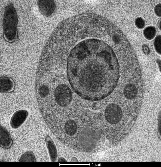 Descubren el virus marino más grande y complejo del mundo 