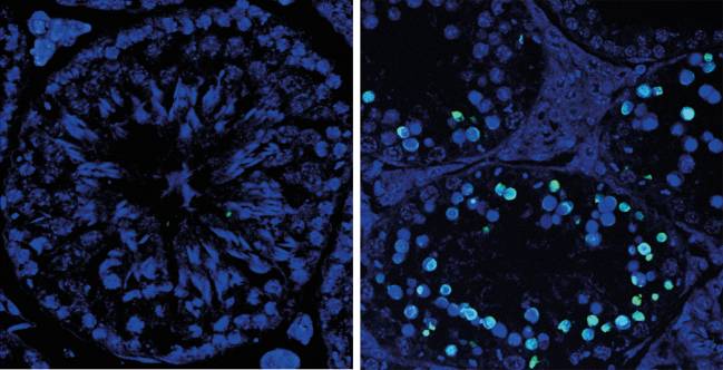 Descubren una proteína imprescindible para formar óvulos y espermatozoides