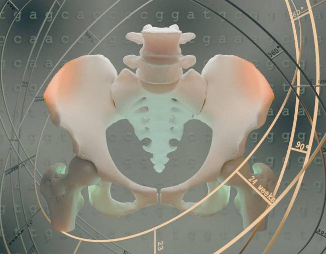 imagen de una pelvis