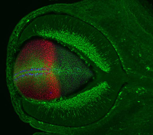 Dos proteínas que causan malformaciones oculares podrían estar relacionadas con el alzhéimer