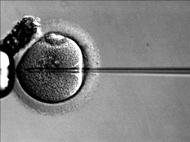 El 50% de las parejas andaluzas sometidas a fecundación "in vitro" donan los embriones sobrantes a la investigación