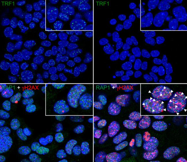 El cáncer deja de ser inmortal