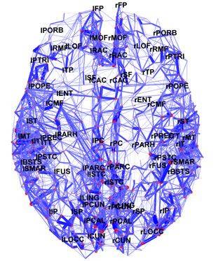 El cerebro recupera las palabras que las personas quieren expresar en menos de 200 milisegundos