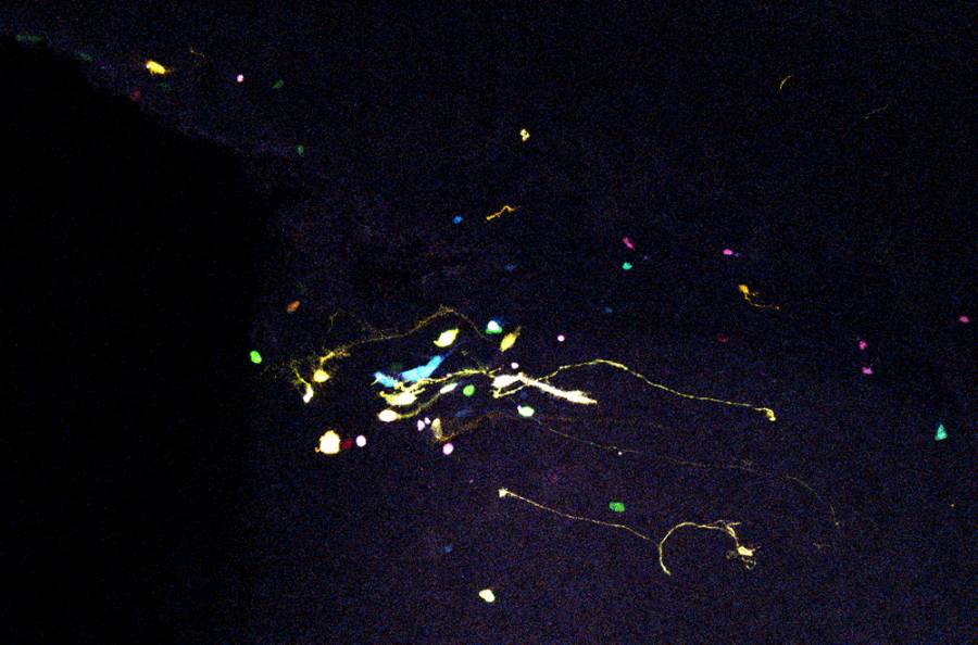 El cerebro tiene células madre capaces de generar neuronas después de nacer