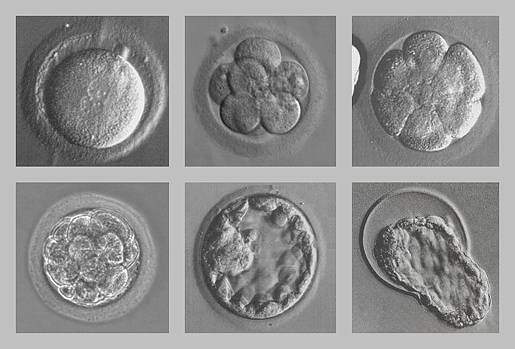 El ‘padre’ de la fecundación in vitro gana el Premio Nobel de Medicina