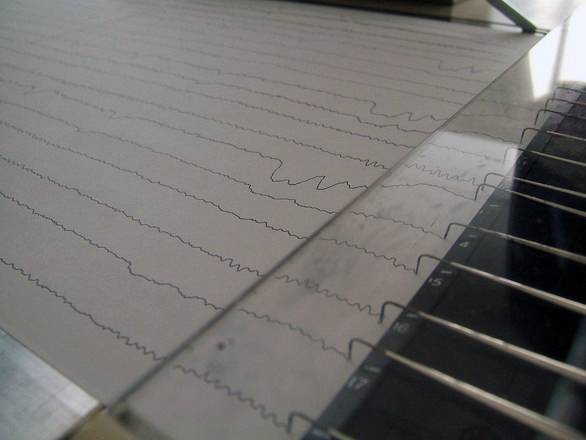 El ritmo de las ondas cerebrales se asocia con los problemas lingüísticos del autismo