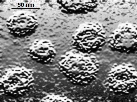 El virus del papiloma humano no causa la mayoría de los tumores de células escamosas en pacientes con anemia de Fanconi