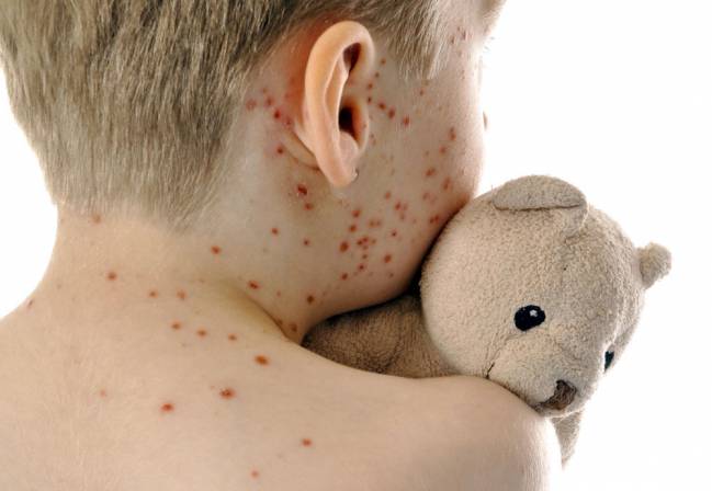 Estrategias de las webs antivacunas: tecnicismos, anécdotas y falsa ciencia