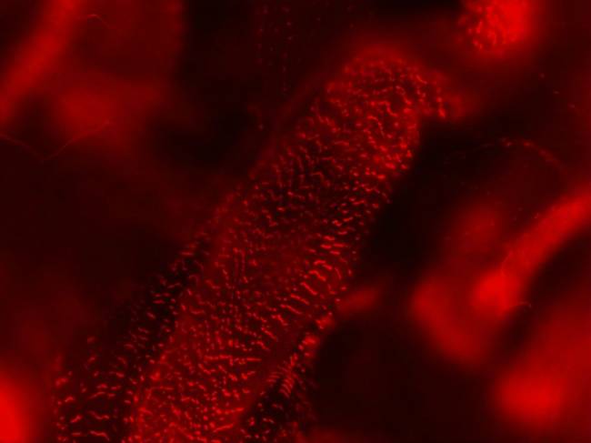 Estudian la distrofia miotónica con 'Drosophila' como modelo biomédico
