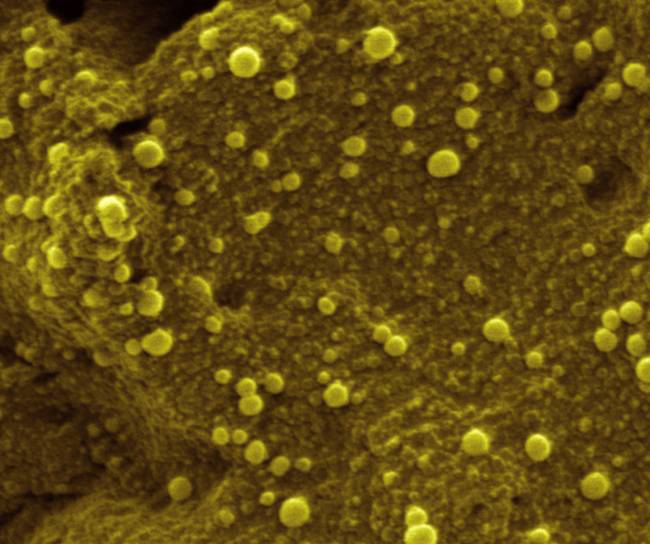 Estudian metales nanométricos con aplicaciones en medicina y energía