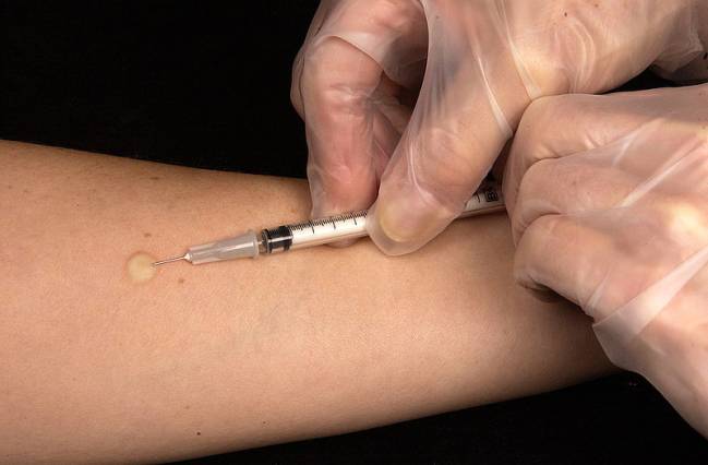 Finalizan los primeros ensayos clínicos de la vacuna española contra la tuberculosis