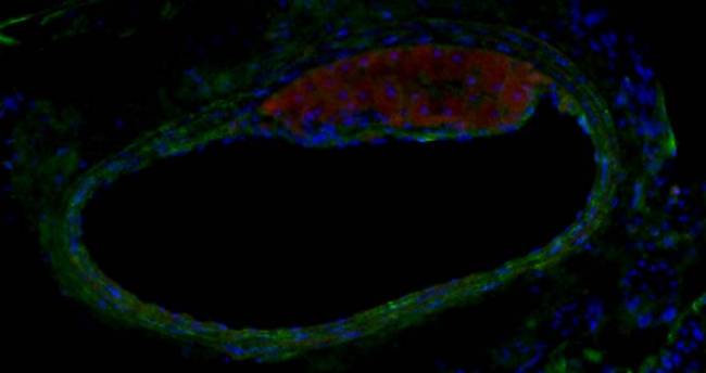 Hallada una nueva molécula eficaz contra la aterosclerosis y la miocarditis