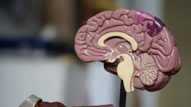 Hallan un incremento de una proteína en el cerebro y el líquido cefalorraquídeo de personas con alzhéimer