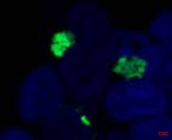 Identifican dos potenciales dianas para tratar la enfermedad de Parkinson