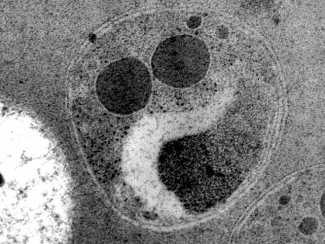 Identifican las necesidades de investigación y desarrollo para erradicar la malaria