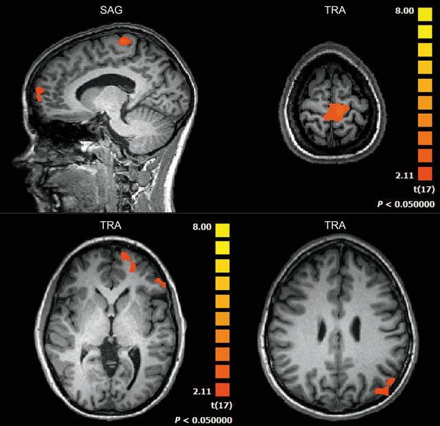 Identifican las zonas del cerebro que se activan con un sistema de realidad virtual 
