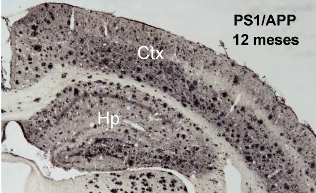 Identifican marcadores del Alzheimer que contribuirán al desarrollo de nuevos fármacos