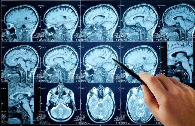 cerebro, recuerdos