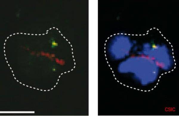 Identifican un mecanismo de inestabilidad genómica