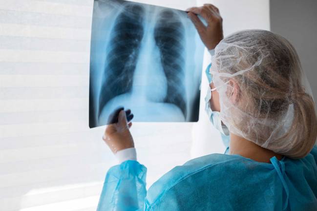 Doctora analiza una radiografía de los pulmones
