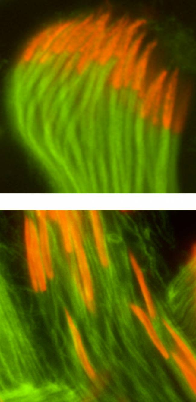Identifican una proteína clave en el ensamblaje de la cola de los espermatozoides