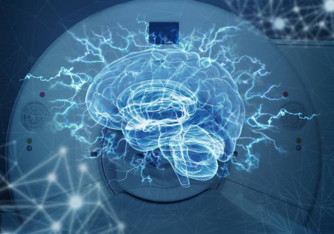 Imágenes del cerebro refutan una teoría de los años 60 sobre el dominio del lenguaje