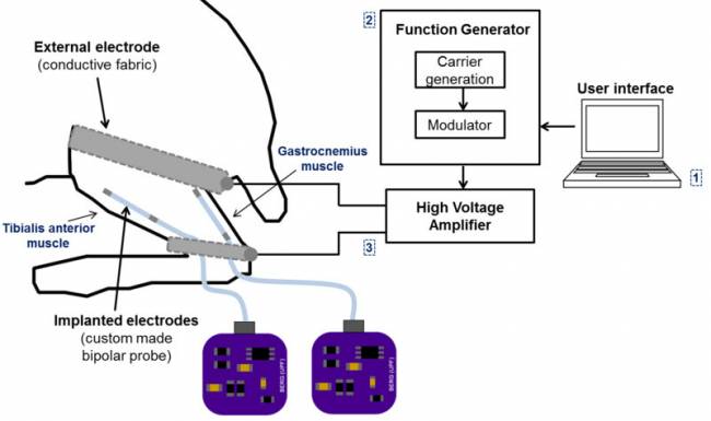 Implantes mínimamente invasivos para estimulación eléctrica selectiva