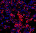 Investigadores del IMIM consiguen generar por primera vez células pancreáticas con fenotipo acinar