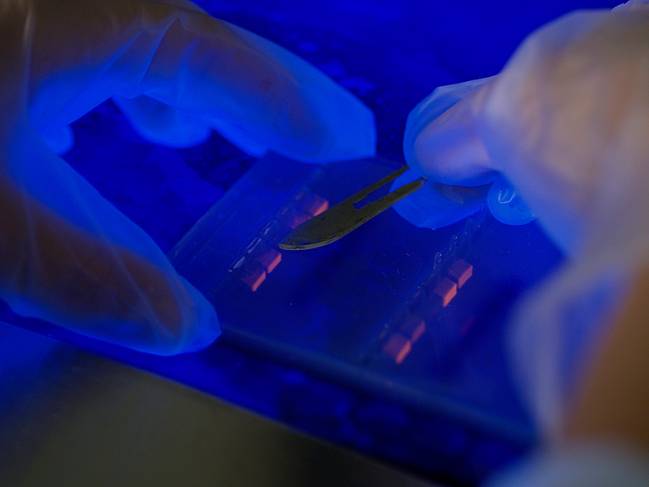 La bioestadística genera nuevos predictores genéticos de enfermedades