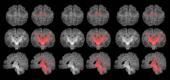 La contaminación atmosférica afecta a la maduración cerebral del bebé 
