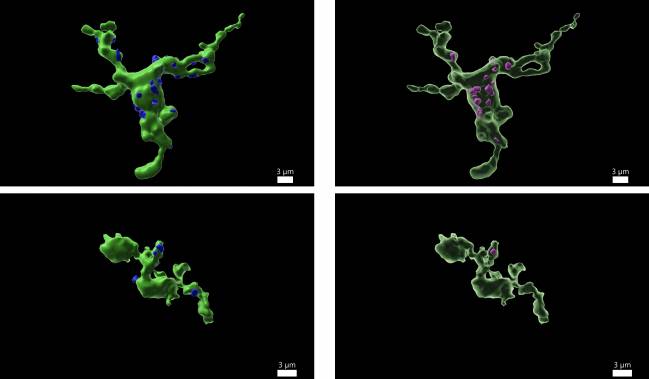 La fertilidad está relacionada con las células inmunitarias del cerebro