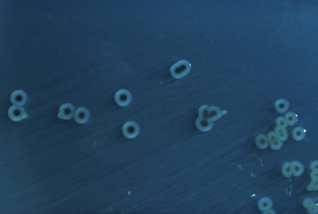 La infección de la bacteria causante de la salmonelosis depende del hierro
