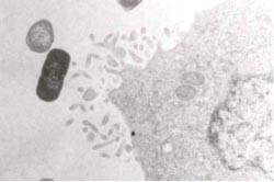 La leche materna es fuente de bifidobacterias beneficiosas para la salud