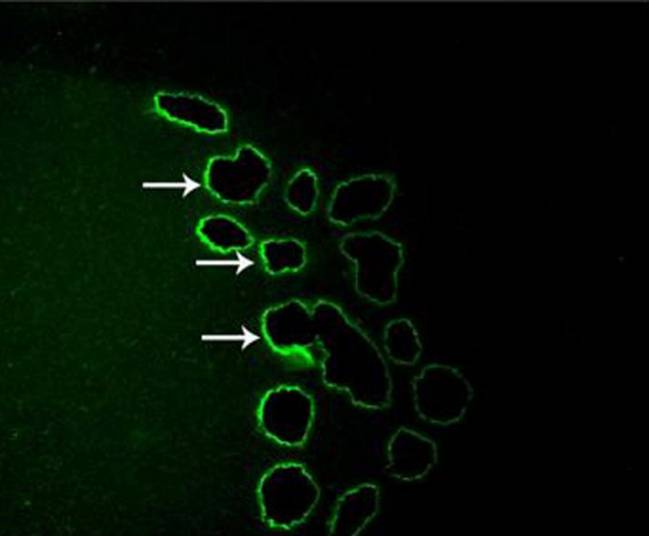 La nicotina activa receptores en el cerebro que reducen el apetito
