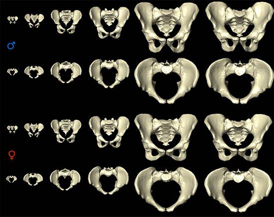 La pelvis femenina cambia con los años para facilitar el parto