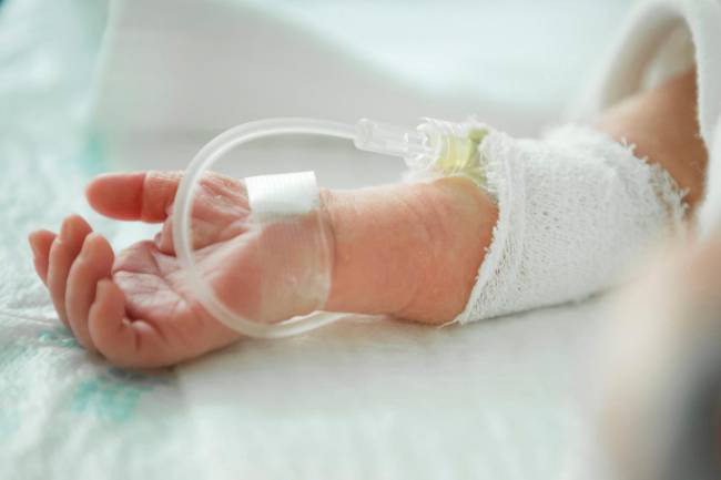 prematuro, hospital, pruebas médicas