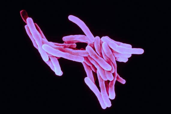 La vacuna candidata contra la tuberculosis muestra seguridad y respuesta inmunitaria