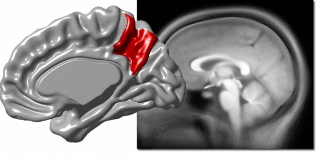 La variabilidad del precúneo del cerebro está asociada a la corteza cerebral
