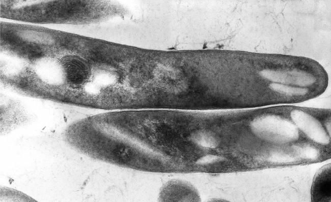 Las cepas de tuberculosis asiáticas no siempre presentan alto riesgo