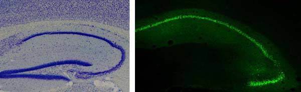 Las convulsiones en enfermedades neurodegenerativas, asociadas a una proteína