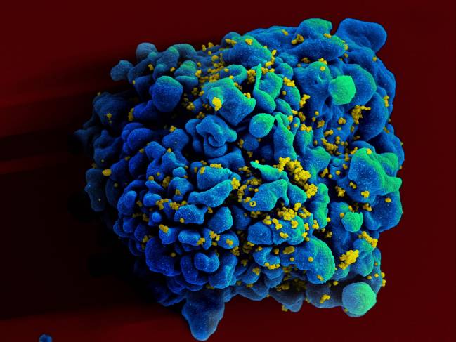 Las matemáticas revelan que el tratamiento simultáneo contra el VIH y la hepatitis C aumenta su éxito