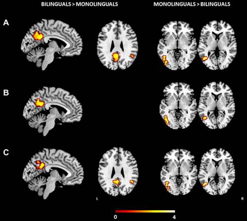 Los bilingües presentan diferencias en el cerebro al hablar su lengua materna