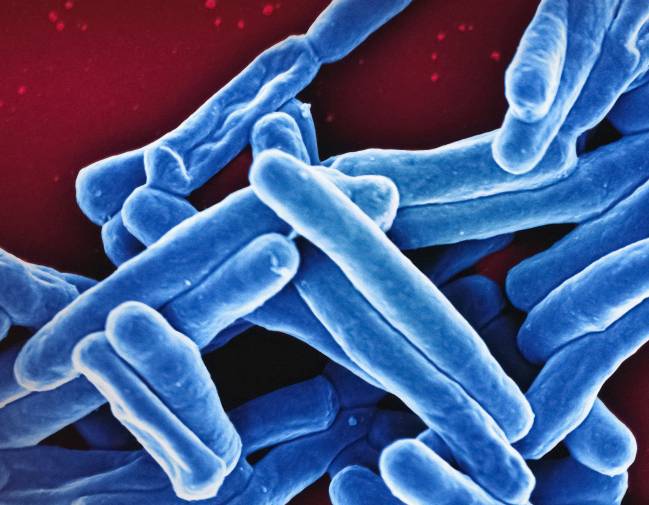Los casos de tuberculosis repuntan un 8,3 %, aunque siguen por debajo que en 2015