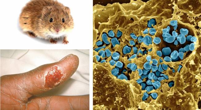 Los casos de tularemia en humanos se disparan durante los años de plaga de topillo