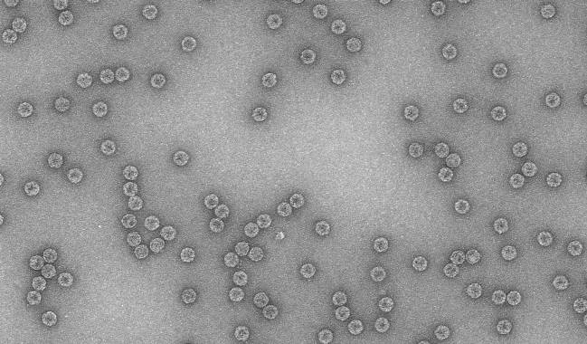 virus