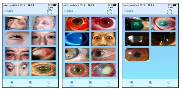 Nueva ‘app’ para ayudar al diagnóstico oftalmológico en Atención Primaria