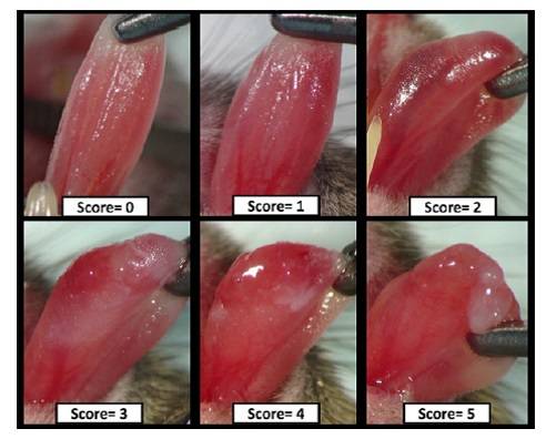 Nueva molécula contra los cánceres de cabeza y cuello