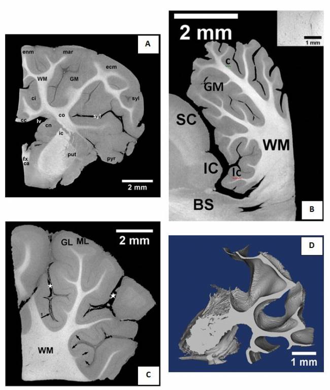 Nueva técnica para visualizar el tejido cerebral