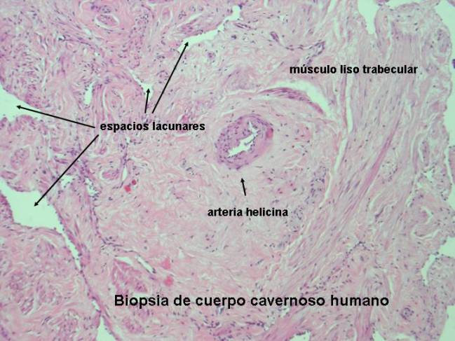 Nuevo antioxidante contra la disfunción eréctil asociada a la diabetes