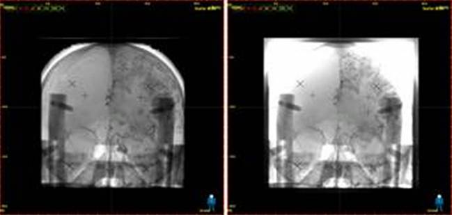 Nuevo sistema de imagen radiográfica para la aplicación médica e industrial